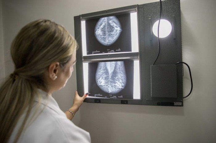 Comissão discute importância do diagnóstico precoce de casos de câncer