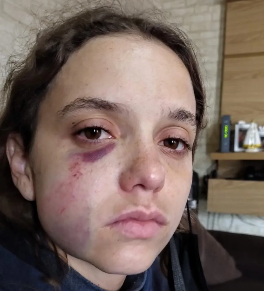 INJUSTIÇA: jovens trabalhadores que defenderam mulher agredida com barra de ferro no rosto vão a júri popular em Campinas