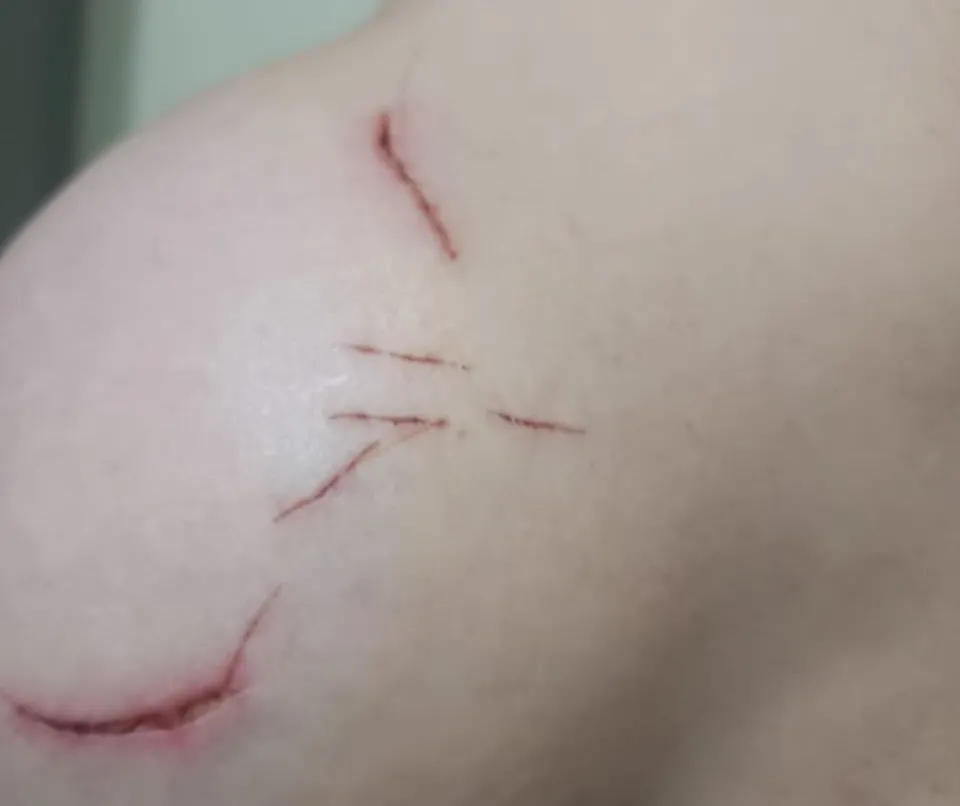 ‘Tive medo de morrer e apanhei muito”, diz mulher que estava no motel de Mogi Guaçu com o homem que faleceu