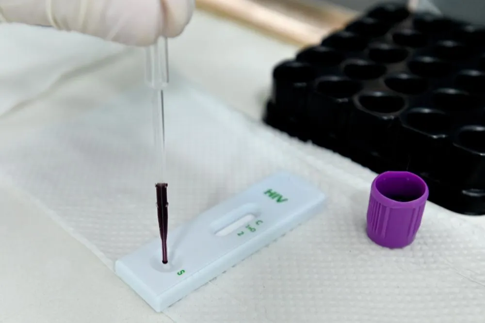 Campinas é escolhida para estudo com injeção preventiva de HIV