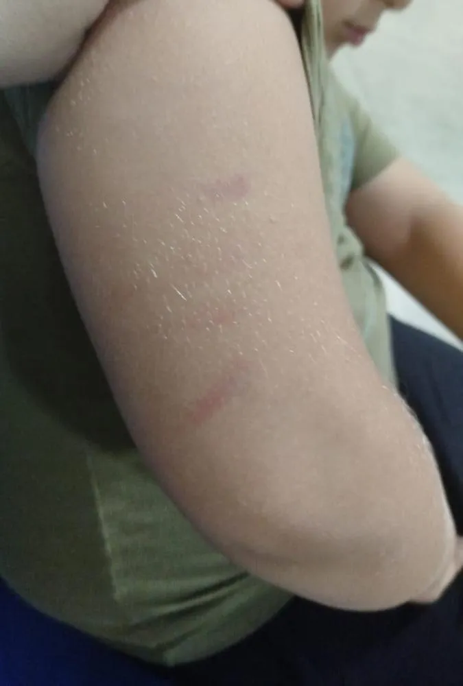  Mãe denuncia agressões contra filho com autismo em escola municipal de Mogi Guaçu