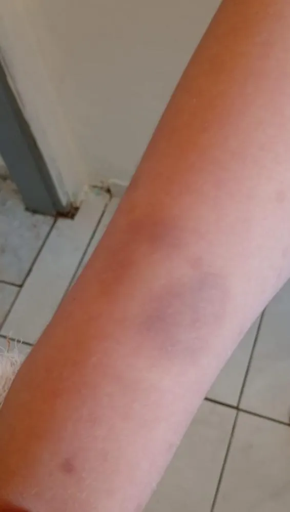 Polícia investiga suposta agressão contra menino com autismo em escola de Mogi Mirim